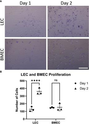 Characterization and assessment of lung and bone marrow derived endothelial cells and their bone regenerative potential